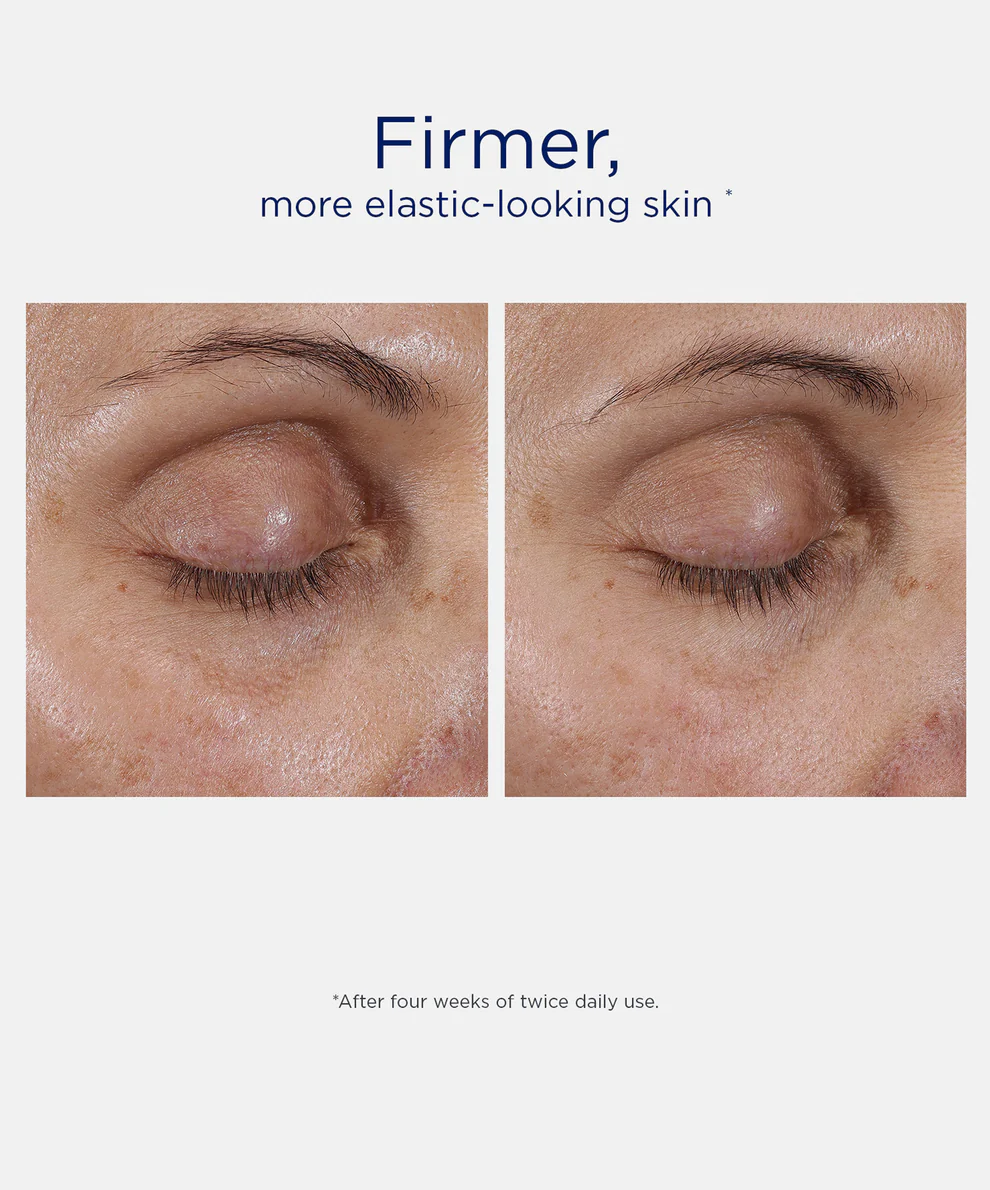 NIET-NeoStrata Intensive Eye Therapy